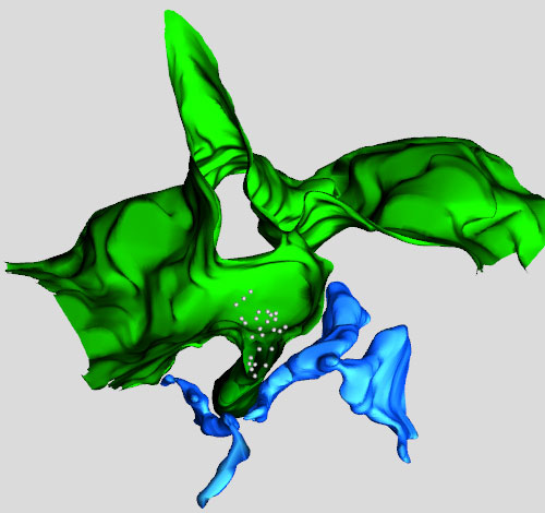 A 3-D Reconstruction by Electronic Tomography (ET) of an area of cell surface (in green) that folds into the cell interior, trapping receptors (white spheres). The endoplasmic reticulum (in blue) is in contact with the inwardly folded cell surface and is pulling it away and dragging it within the cell. In this way. the receptors are removed from the cell surface.