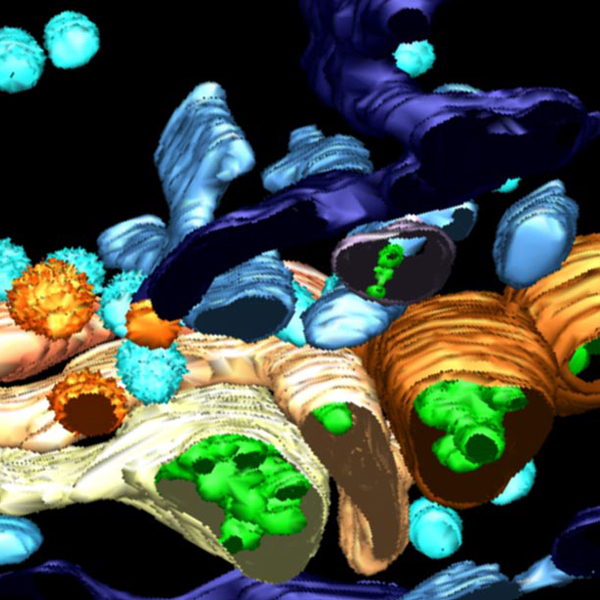 Microscopia elettronica cellulare e dei tessuti